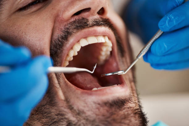 Best Emergency Denture Repair in Solomons, MD