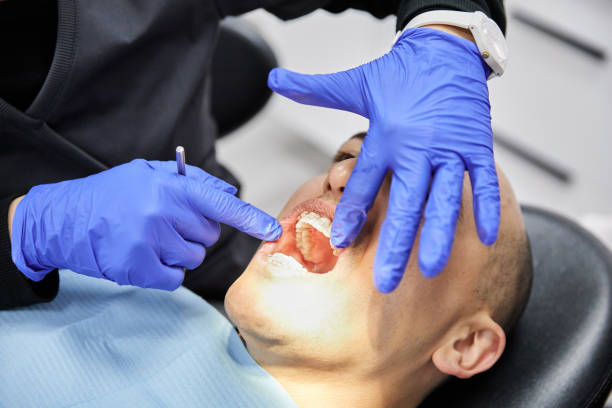 Best Emergency Dental Care for Broken or Chipped Teeth in Solomons, MD